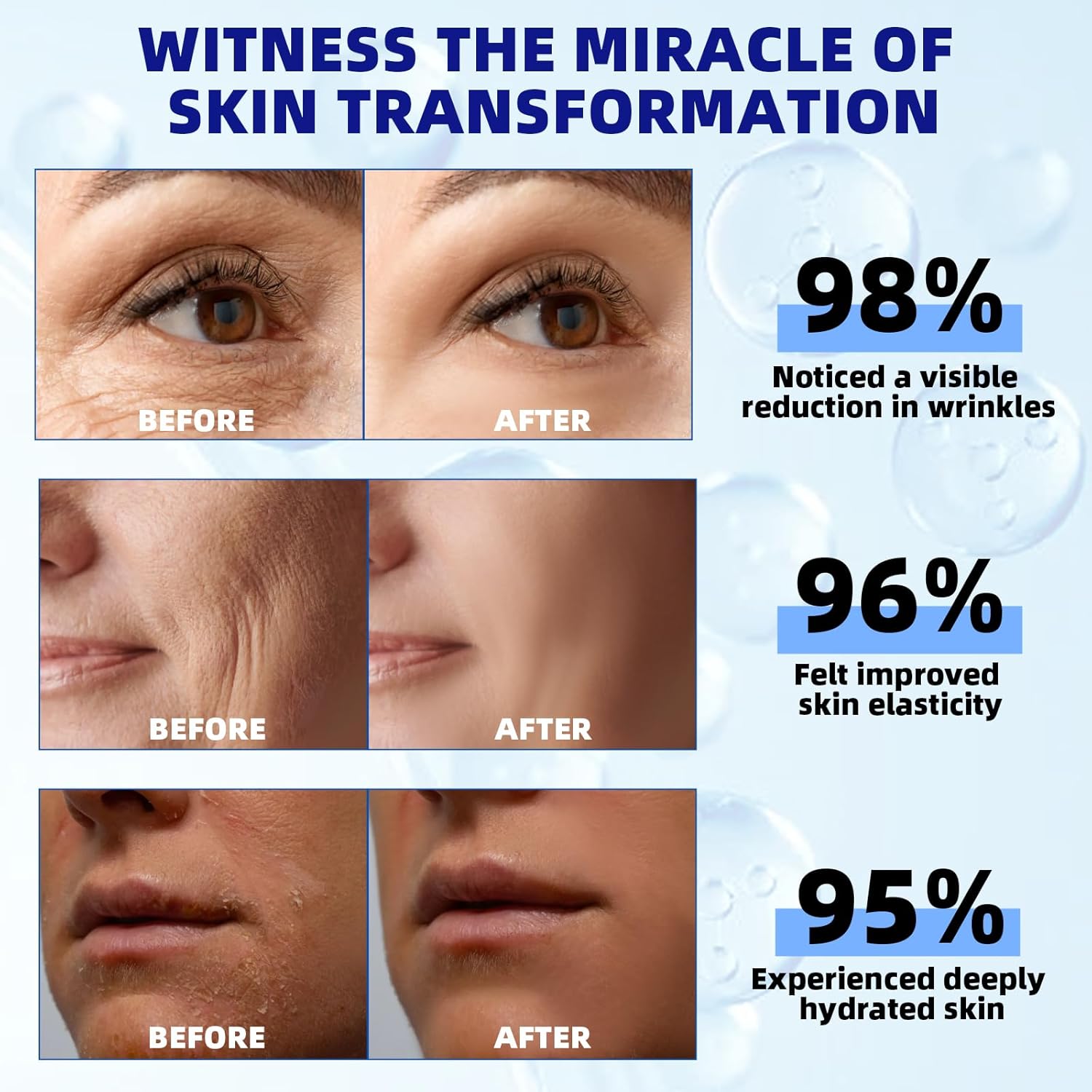 Retinol Serum for Face, 2.5% Retinol Intense Night Serum with Squalane,Vitamin C & E & B3,Hyaluronic Acid for Lines, Wrinkles & Premature Sun Damage to Resurface & Hydrate 30 ml/ 1 Fl oz - Image 5