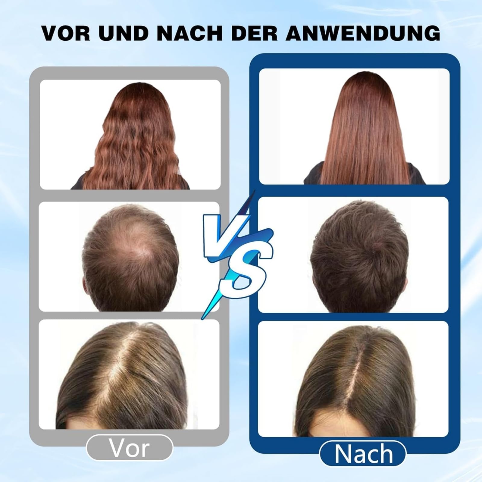 Depura - Siero Rigenerante per Capelli，Siero per Capelli Roll On al Rosmarino, Anti-Caduta e Crescita Capillare, Nutre Cuoio Capelluto e Rafforza Radici