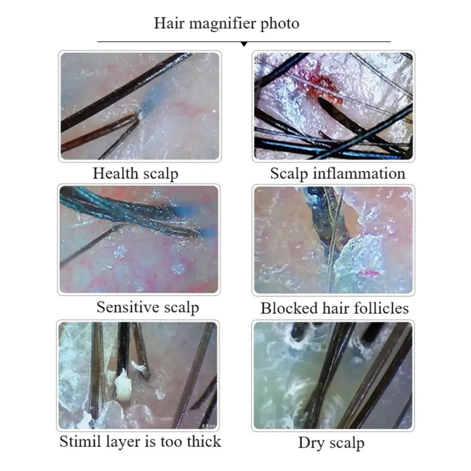 Hautdiagnose-Haaranalysator, 11-Zoll-Haut- und Kopfhautdetektor zur Erkennung der Haut- und Kopfhautgesundheit mit 50-facher/200-facher Linse für den Heim- und Salongebrauch