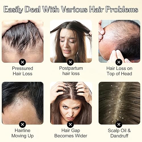 Miniatura 6 de Champú para el cabello con extracto de planta de jengibre, champú para el cabello con extracto de planta de jengibre, champú nutritivo para cabello