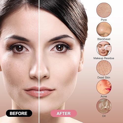 Miniatura 5 de Cepillo de limpieza facial sónico, recargable impermeable exfoliante removedor de maquillaje masaje, instrumento de limpieza eléctrica, lavado