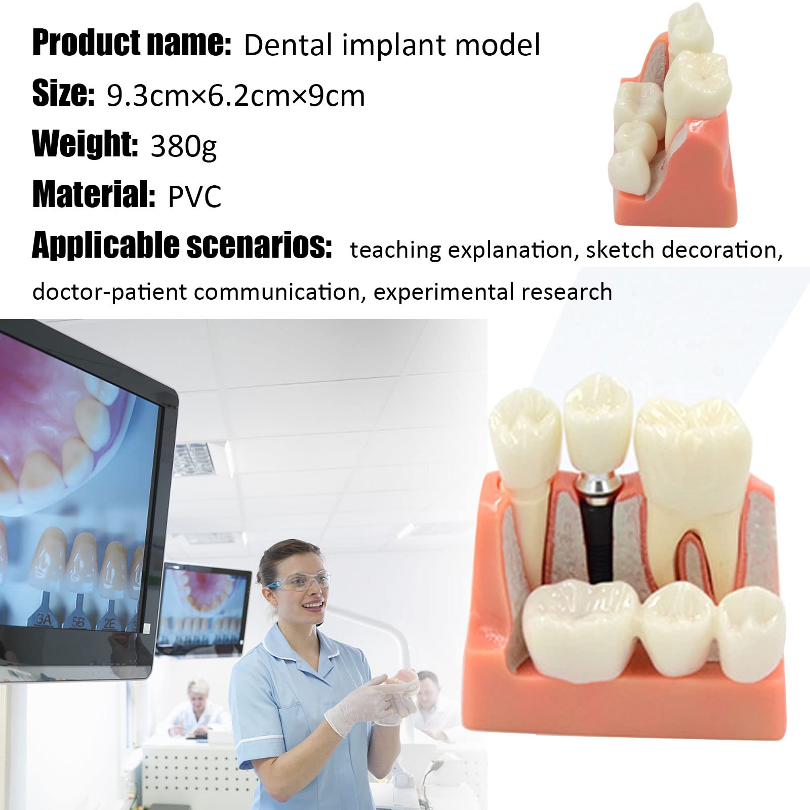 Amovible Modèle D'implant, Modèle Dentaire de Pont de Couronne, Modèle de Dent pour Aidant Le Dentiste et Le Patient à Communiquer et à Discuter du Plan de Traitement, Intuitif et Portable