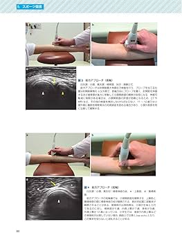 Medical Technology別冊 超音波エキスパート19 運動器領域の超