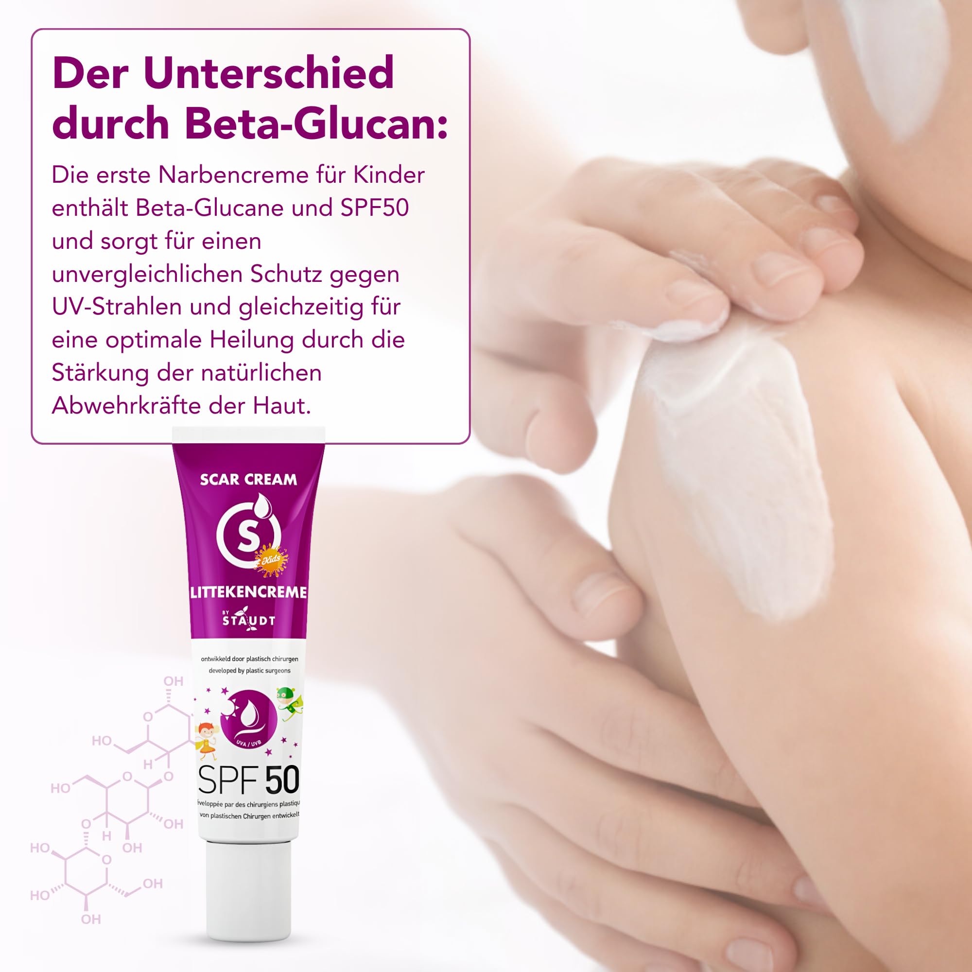 Staudt Kinder Narbensalbe SPF50 - Pädiatrisches Silicone Gel für empfindliche Haut - Hydratisierende Wund- und Heilsalbe mit Allantoin & Aloe Vera - UV-Schutz - 40ml