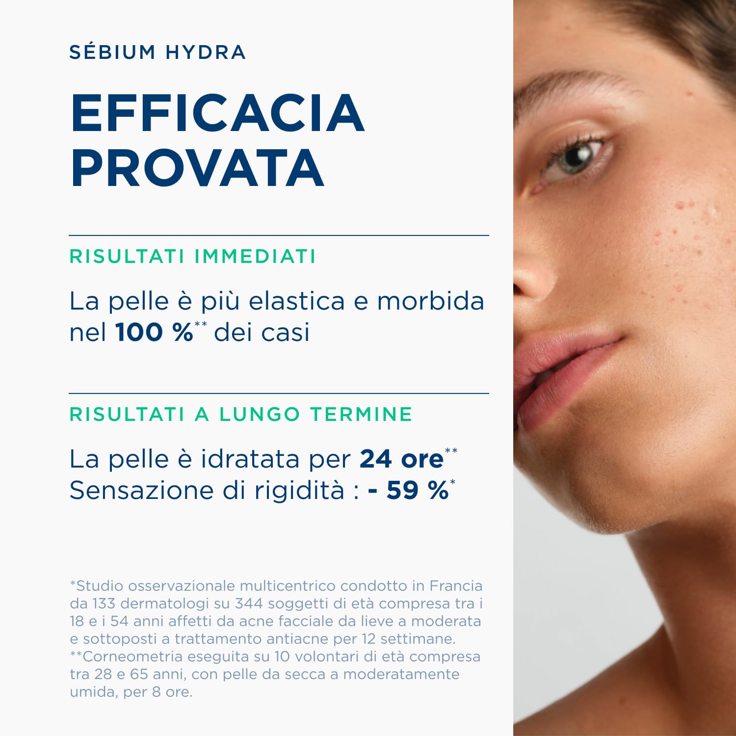 BIODERMA Sébium Hydra - Trattamento Idratante e Nutriente - Per la Pelle a Tendenza Acneica - Compensa gli Effetti Collaterali dei Trattamenti Antiacne - Tubo da 40 ml