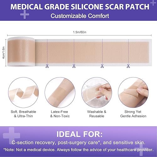 Miniatura 7 de Hojas de silicona para cicatrices, cinta de silicona de 1.6 x 60 pulgadas, hoja de cicatriz de silicona profesional reutilizable para cicatrices