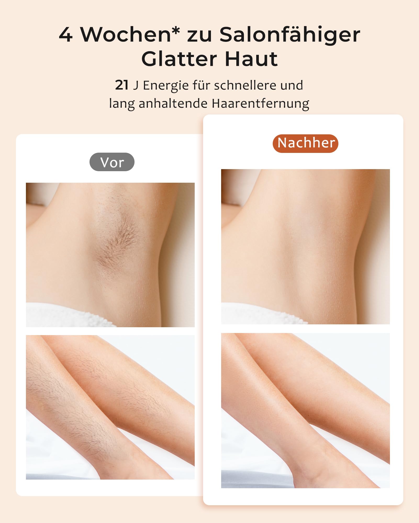 Geräte Haarentfernung mit 8℃ Kühlsystem, Schmerzfreie Haarentfernung Zuhause, 9 Energiestufen 21J für Damen Herren, Gesich Achseln Bikini Beine Körper, Gold