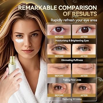 BREYLEE Renewal Eye Serum with Coffine Niacinamide Polypeptide, Eye Care for Puffy Eye Bags Fine Lines Dark Circles Wrinkles, Anti-Puffiness & Fading Fine Lines