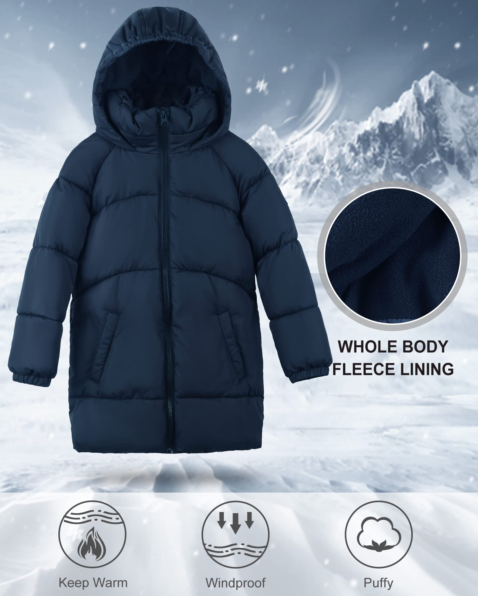 SOLOCOTE Niñas Invierno Abrigos Niños Pesado Mediana Longitud Chaquetas Caliente Puffly Down-like Algodón Guata Ropa de abrigo para niños