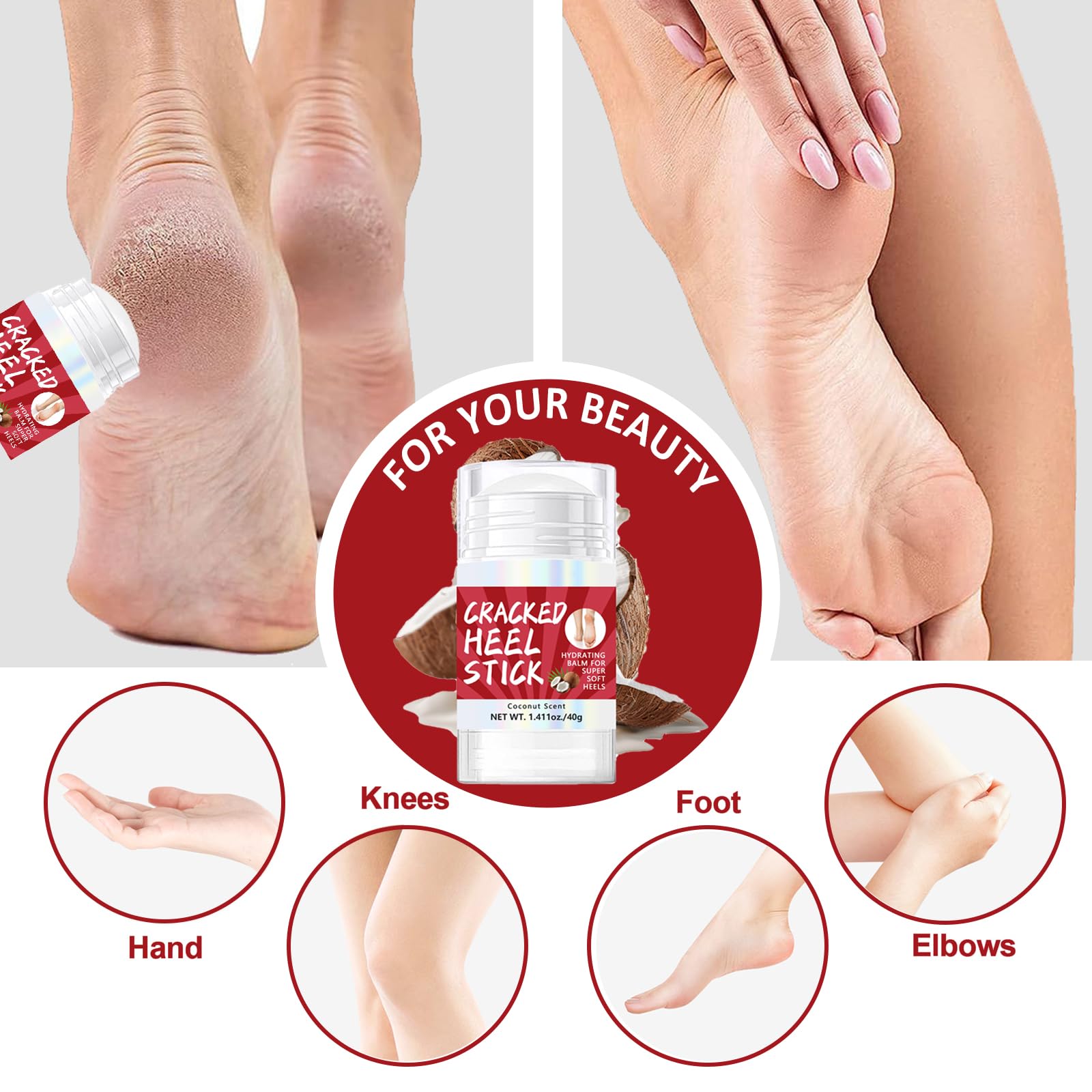 Foot Cream For Cracked Heels And Dry Skin- Foot Cream With Coconut Extract, Cracked Heel Balm With Coconut Oil - Image 4