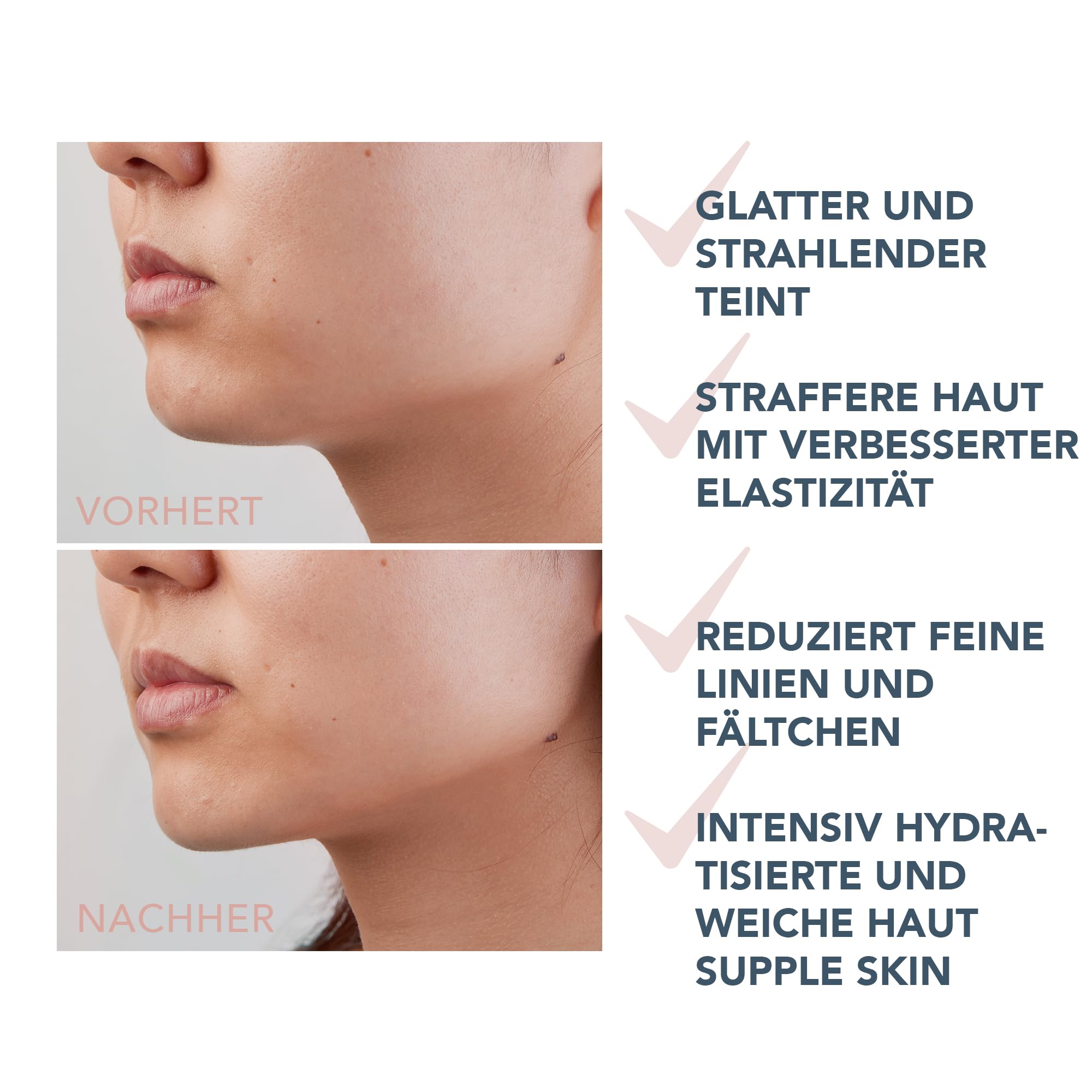 FOREO SUPERCHARGED Straffendes Serum mit Dreifach-Wirkung - Leitfähiges Gel - Hyaluronsäure & Squalan - Feuchtigkeits-Serum Gesicht - Vegan & tierversuchsfrei - Alle Hauttypen - 30 ml