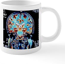 CafePress Coloured MRI Scans Of The Brain, Coronal View 20 O 20 oz Ceramic Coffee Mega Mug