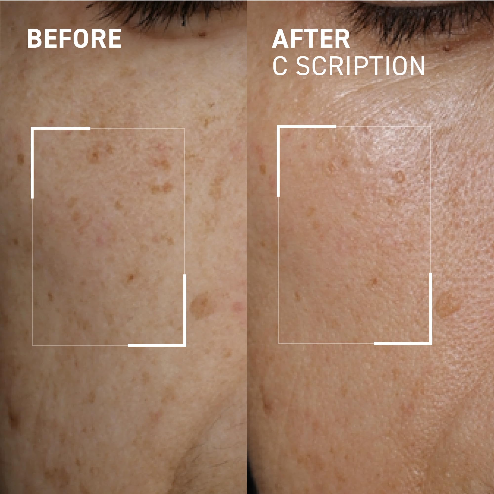 Dr. Brandt Bright This Way C Scription - Concentrated Vitamin C Serum - Fade Dark Spots, Reduce Wrinkles & Illuminate Skin Tone - 30 mL - Image 2