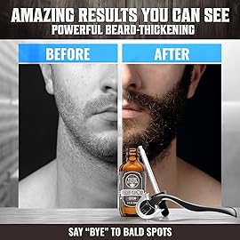 Beard Growth Kit - Oil, Balm, Serum, Derma Roller & Wooden Comb for Beard & Mustache Growth