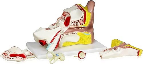 Miniatura 4 de Parco Scientific PB00066 4X Ear | Muestra el oído externo, medio e interno | Las piezas extraíbles incluyen hueso temporal, sección de canal