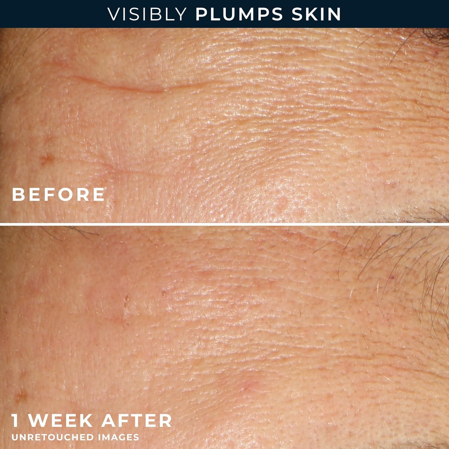 RoC Multi Correxion Hyaluronic Acid Night Serum Capsules (30 CT) for Intense Hydration + RoC Retinol Capsules (7 CT), Anti-Aging Skin Care Wrinkle Treatment for Women and Men - Image 3