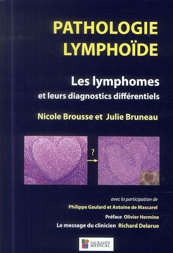PATHOLOGIE LYMPHOIDE - LES LYMPHOMES ET LEURSDIAGNOCTICS DIFFERENTIELS