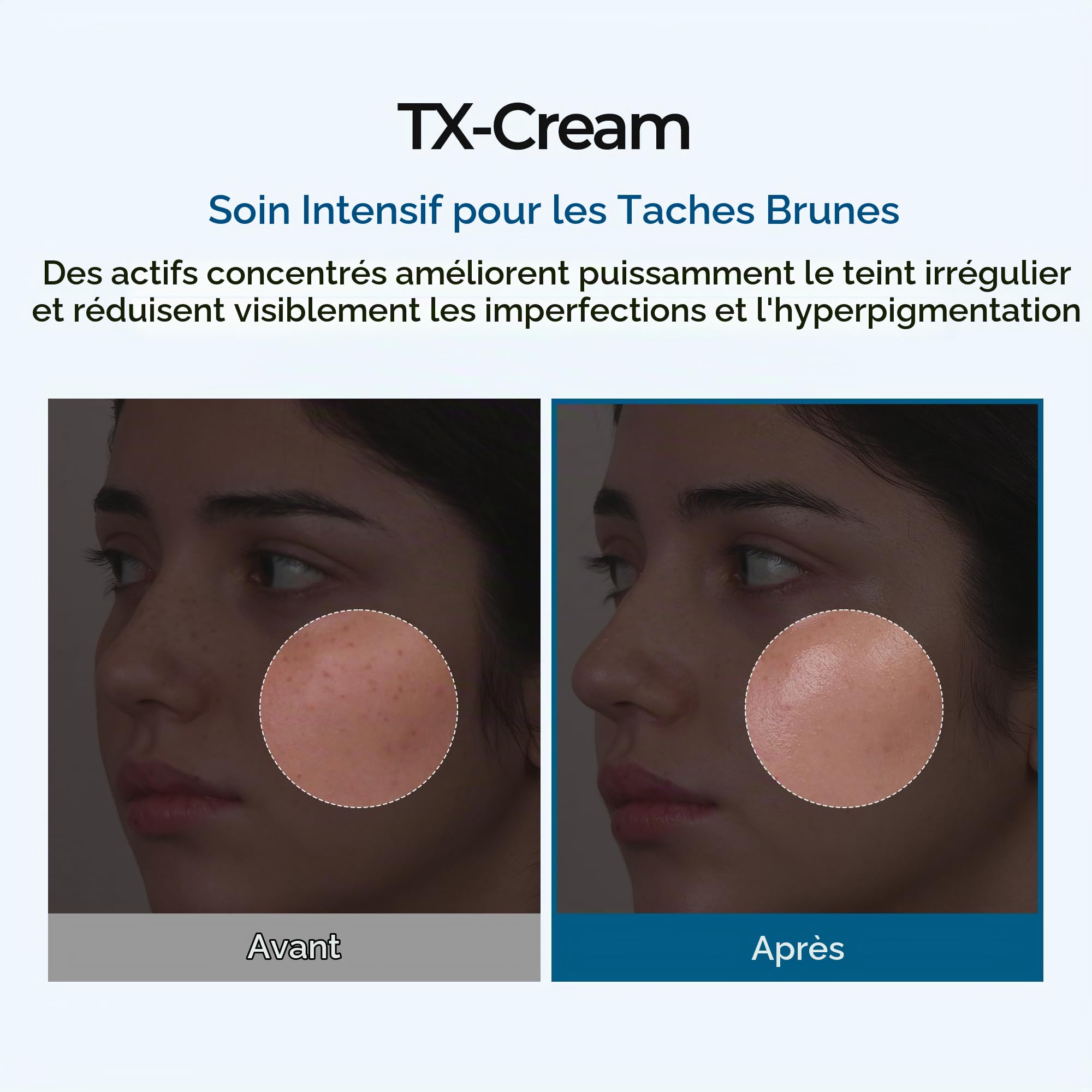 Dr.Melaxin Crème À L'Acide Tranexamique Tx, Soin Coréen Pour Le Teint, 50 Ml (1,69 Fl Oz), Blanche.