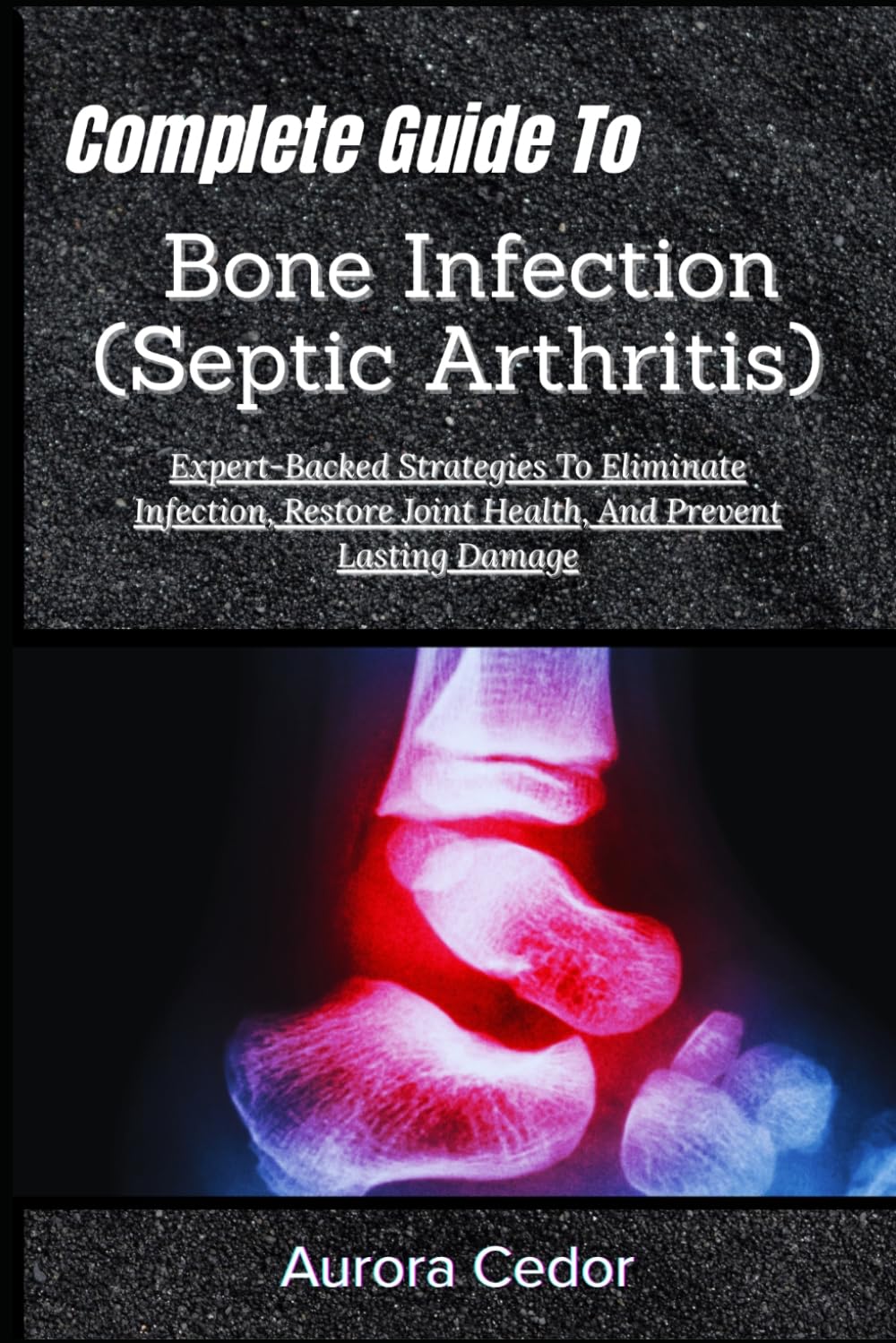 Complete Guide To Bone Infection (Septic Arthritis): Expert-Backed Strategies To Eliminate Infection, Restore Joint Health, And Prevent Lasting Damage