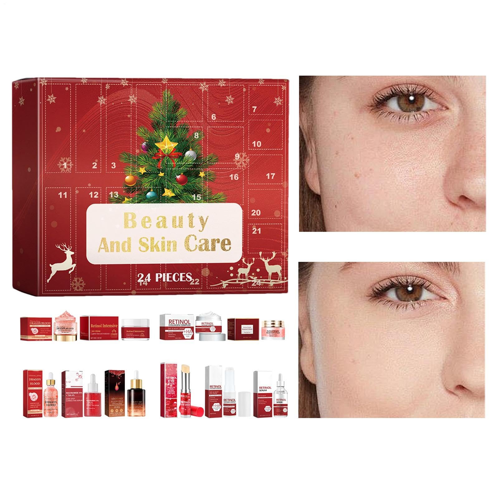 Weihnachts-Countdown-Kalender, Adventskalender, feuchtigkeitsspendende | Lotion, Gesichtscreme, Hautpflege-Set, für Damen, Herren, Spa, Bad, Körper, Geburtstag, Weihnachten