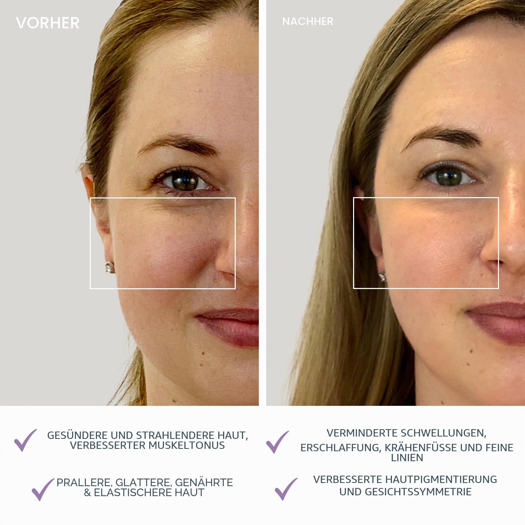 FOREO BEAR mini Gezieltes Mikrostrom-Facelifting-Gerät - Gesichtsmassagegerät gegen falten - Gesicht & Jawline Trainer - Gesichtsmassage - Face lifting gerät-- Anti-Aging - Lavander