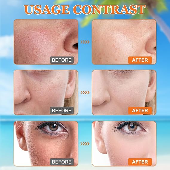 2Pcs Sunscreen SPF 100, Ultra Light UV Protetion Face Sunscreen, Factor 100 Sun Cream for Face & Body, Waterproof Moisturiser Sun Lotion, Refreshing and Non-Greasy, Suitable for All Skin Types