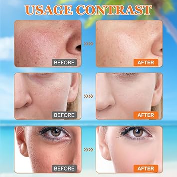 2Pcs Sunscreen SPF 100, Ultra Light UV Protetion Face Sunscreen, Factor 100 Sun Cream for Face & Body, Waterproof Moisturiser Sun Lotion, Refreshing and Non-Greasy, Suitable for All Skin Types