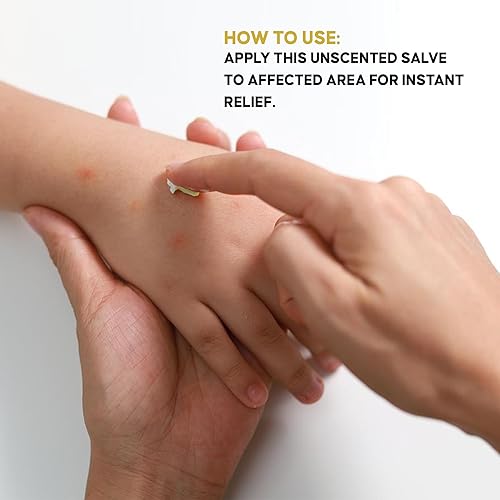 Miniatura 4 de Kimberlys Kupboard Chickweed Healing Salve para proporcionar alivio de picazón, picaduras de abejas y piel seca  3.8 onzas  3.8 fl oz (3.8 fl oz)