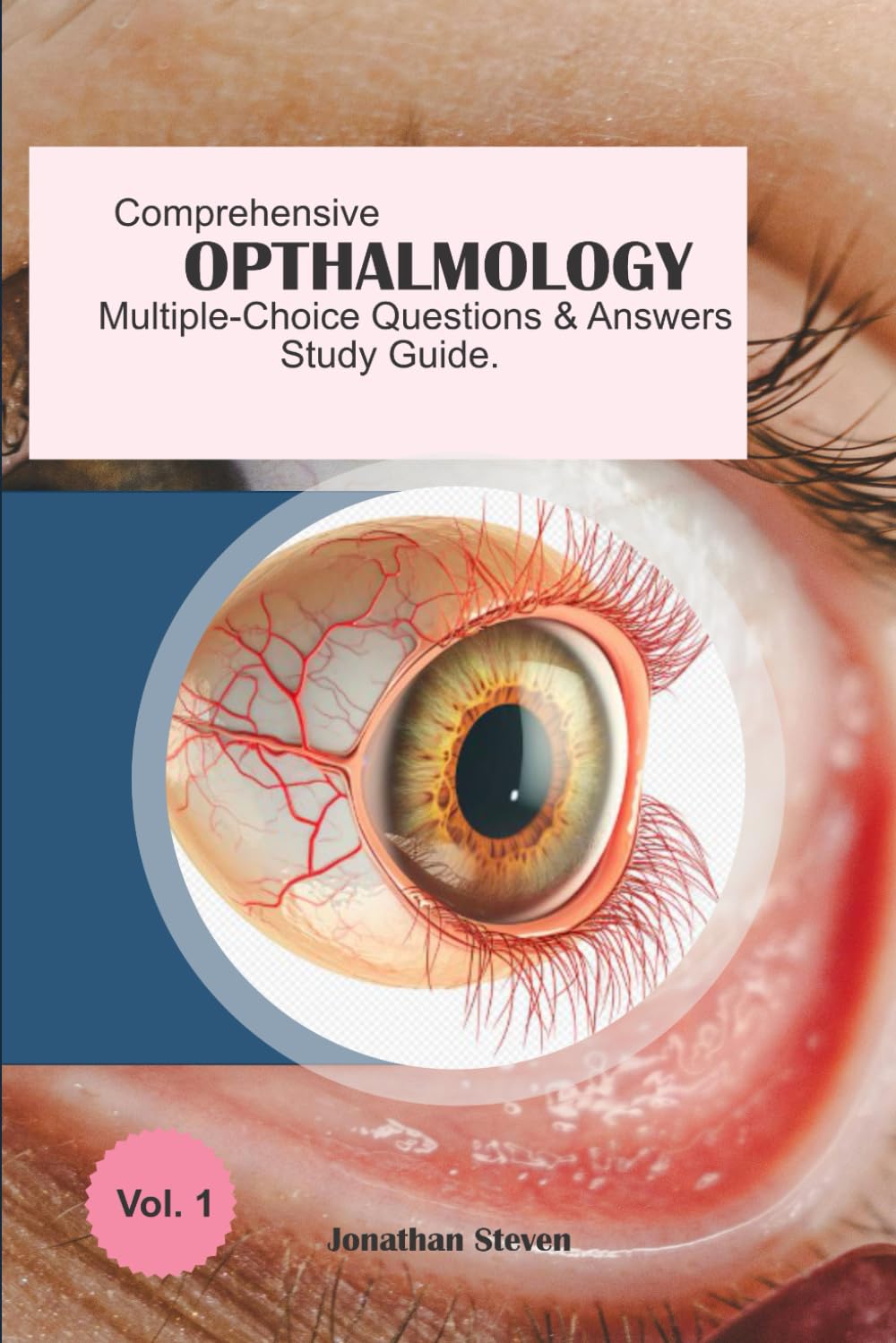 Comprehensive Ophthalmology Multiple-Choice Questions and Answers Study Guide