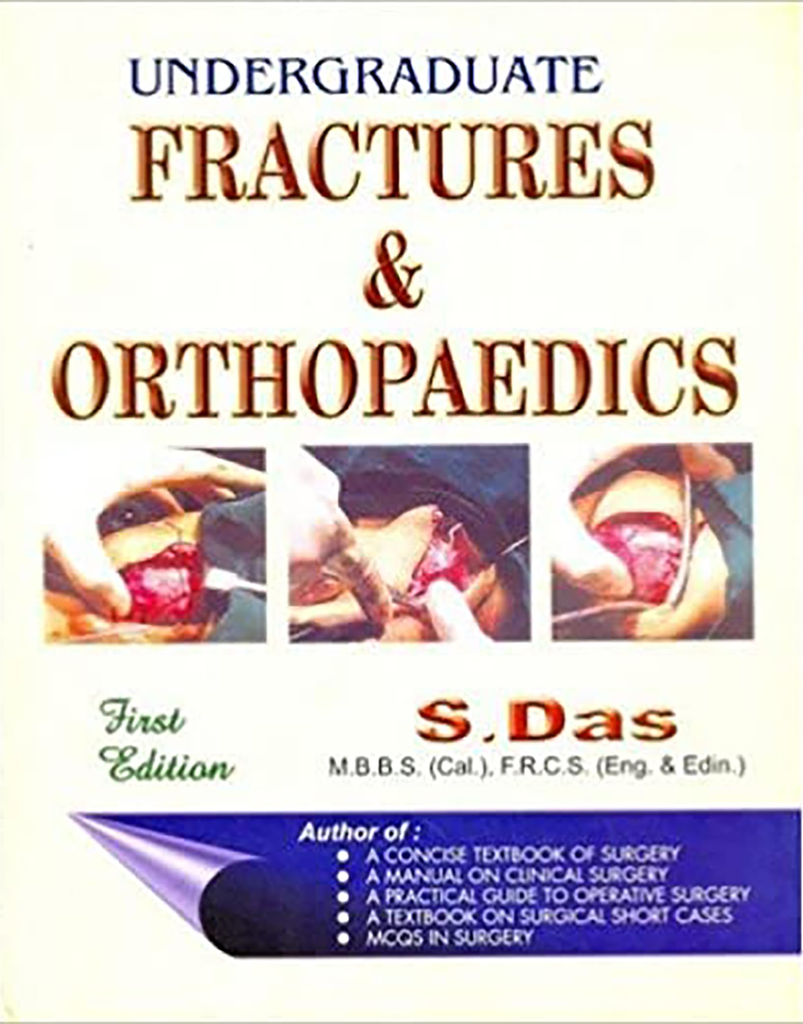 UNDERGRADUATE FRACTURES & ORTHOPAEDICS Paperback – 6 December 2021