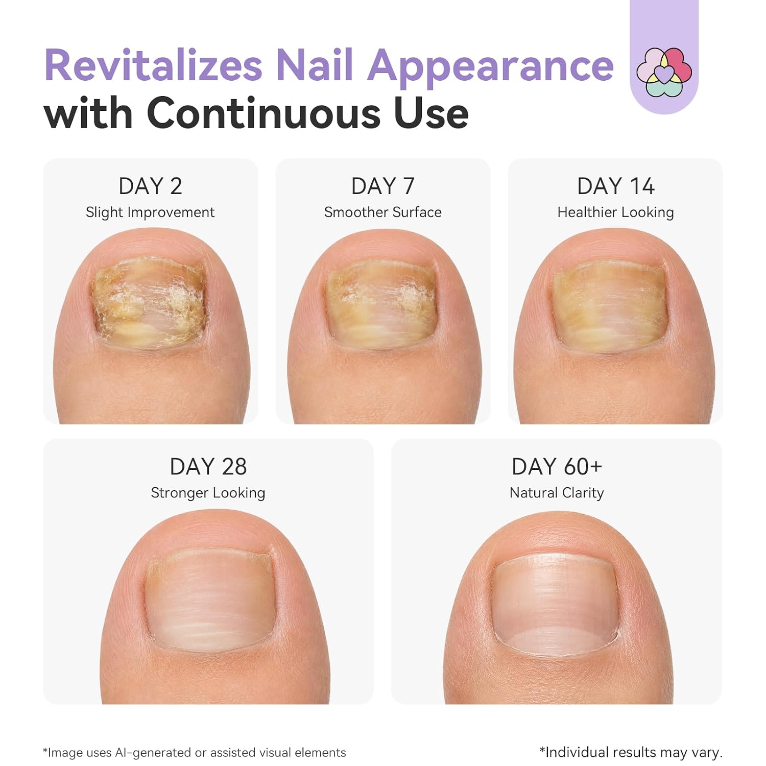 Saviland Fungal Nail Patches Triangle Formula 18 Pcs: Visible Toenail Renew
