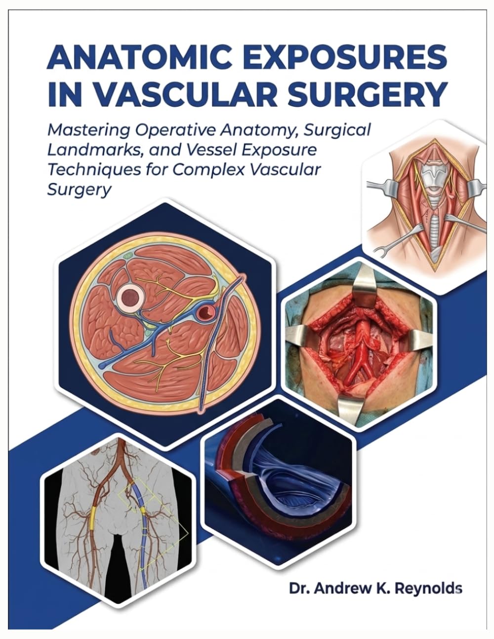 ANATOMIC EXPOSURES IN VASCULAR SURGERY: Mastering Operative Anatomy, Surgical Landmarks, and Vessel Exposure Techniques for Complex Vascular Surgery