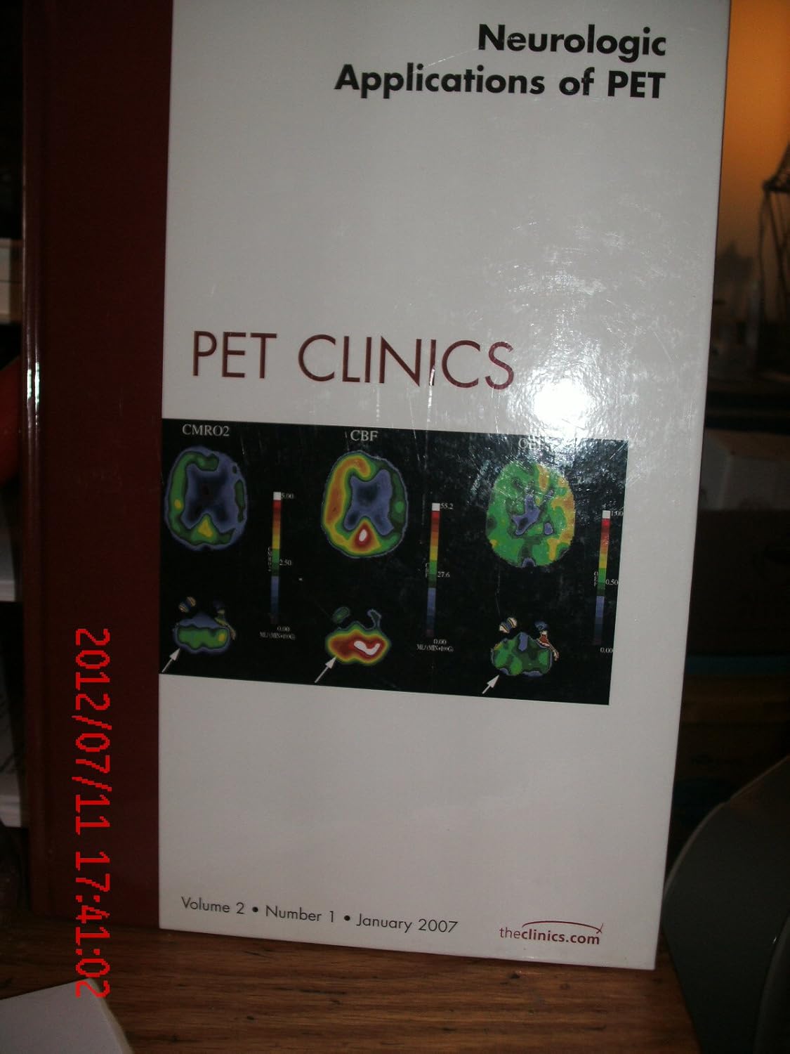 Neurologic Applications of PET, An Issue of PET Clinics (Volume 21) (The Clinics Radiology