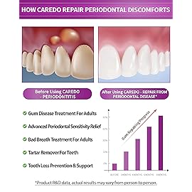 CAREDO Gum Toothpaste for Periodontitis, Gum Repair for Receding Gums, Gum Disease & Gingivitis Treatment, Periodontal Disease Treatment for Gum Health, Gum Disease Repair Bad Breath Toothpaste 3.52OZ