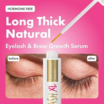 TOPLASH Eyelash Growth Serum – Prostaglandin Free & Hormone Free Lash & Brow Serum for Longer, Thicker, Fuller Lashes – Vegan, Cruelty-Free & Hypoallergenic – 6 ml