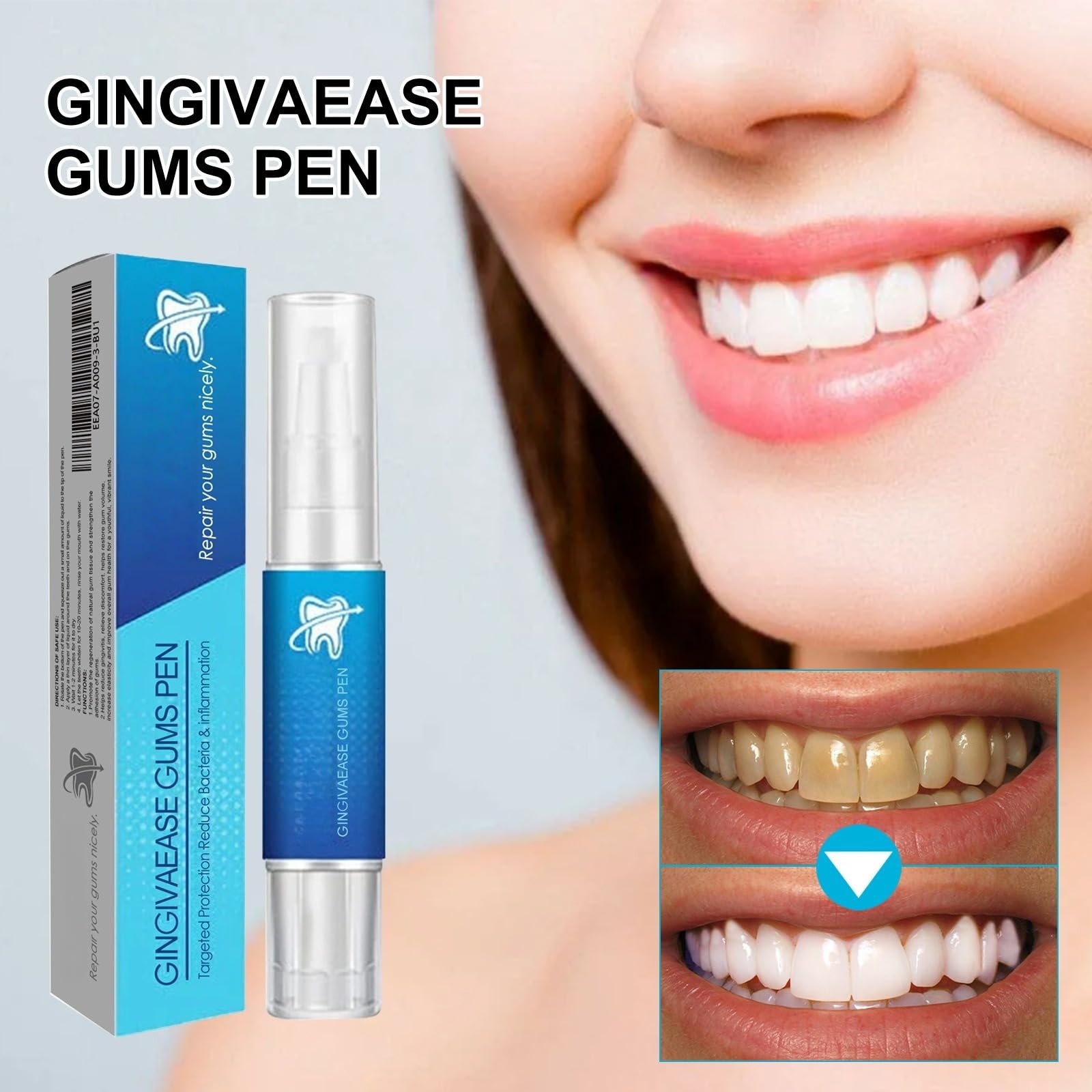 Gel sbiancante dei denti - Ripara i Gonfiori delle Gengive - Penna sbiancante dei denti, terapeutico - Dentifricio - Trattamento della recessione delle gengive - Ringiovanisci il tuo