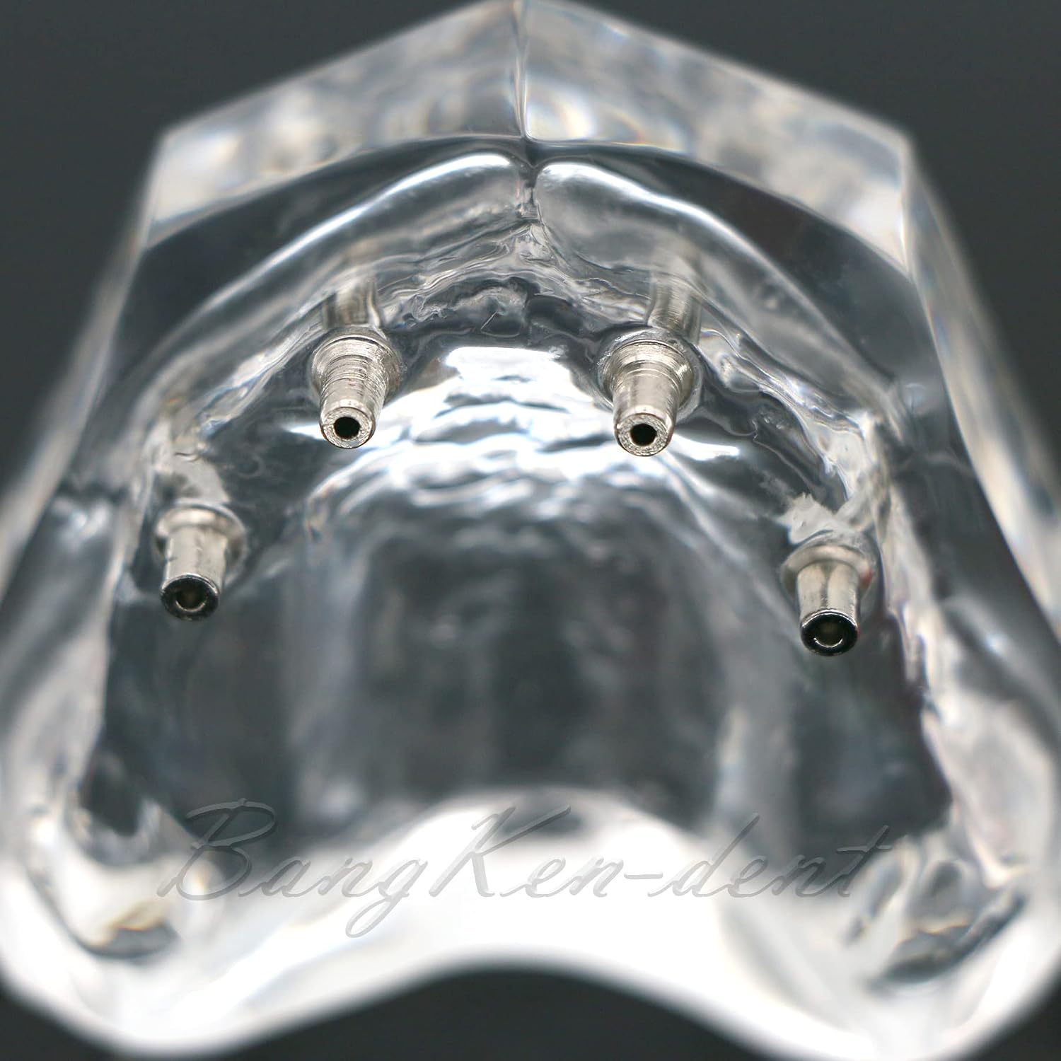 Dental Implant Typodont Restoration Teeth Model M6001 Clear Overdenture 4 Implants Superior Upper Demo for Study Teach