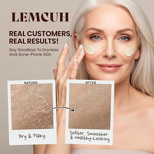 Miniatura 3 de Bálsamo de ternera y miel para piel madura  Reparación hidratante con aceite de jojoba y vitamina E  Crema de sarga natural para piel frágil, seca o