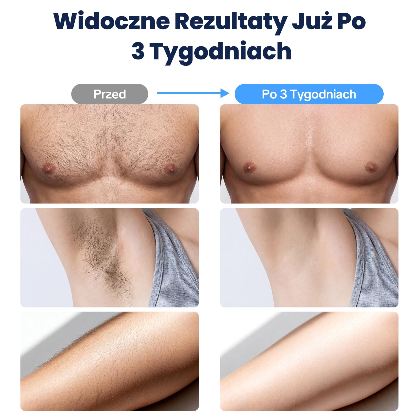 MANKIW IPL impulsowe światło z chłodzeniem, 500000 impulsów | IPL depilator chłodzący, 5 poziomów i 50 0000 impulsów do nóg, pach, bikini, wygodne użytkowanie w domu