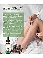 Vista 2 de Aceite Cyperus Rotundus, nuevo aceite Cyperus Rotundus para depilación, 2.0 fl oz de aceite de ciprés natural para todo tipo de piel (2)