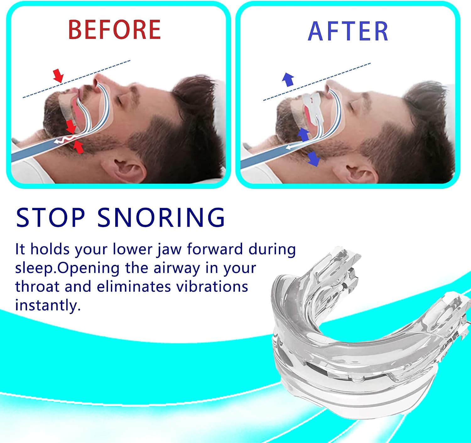 Anti Snoring Devices,Reducing Snoring Solution,Comfortable Anti Snoring Devices - Helps Stop Snoring for Man/Women A Better Night's Sleep
