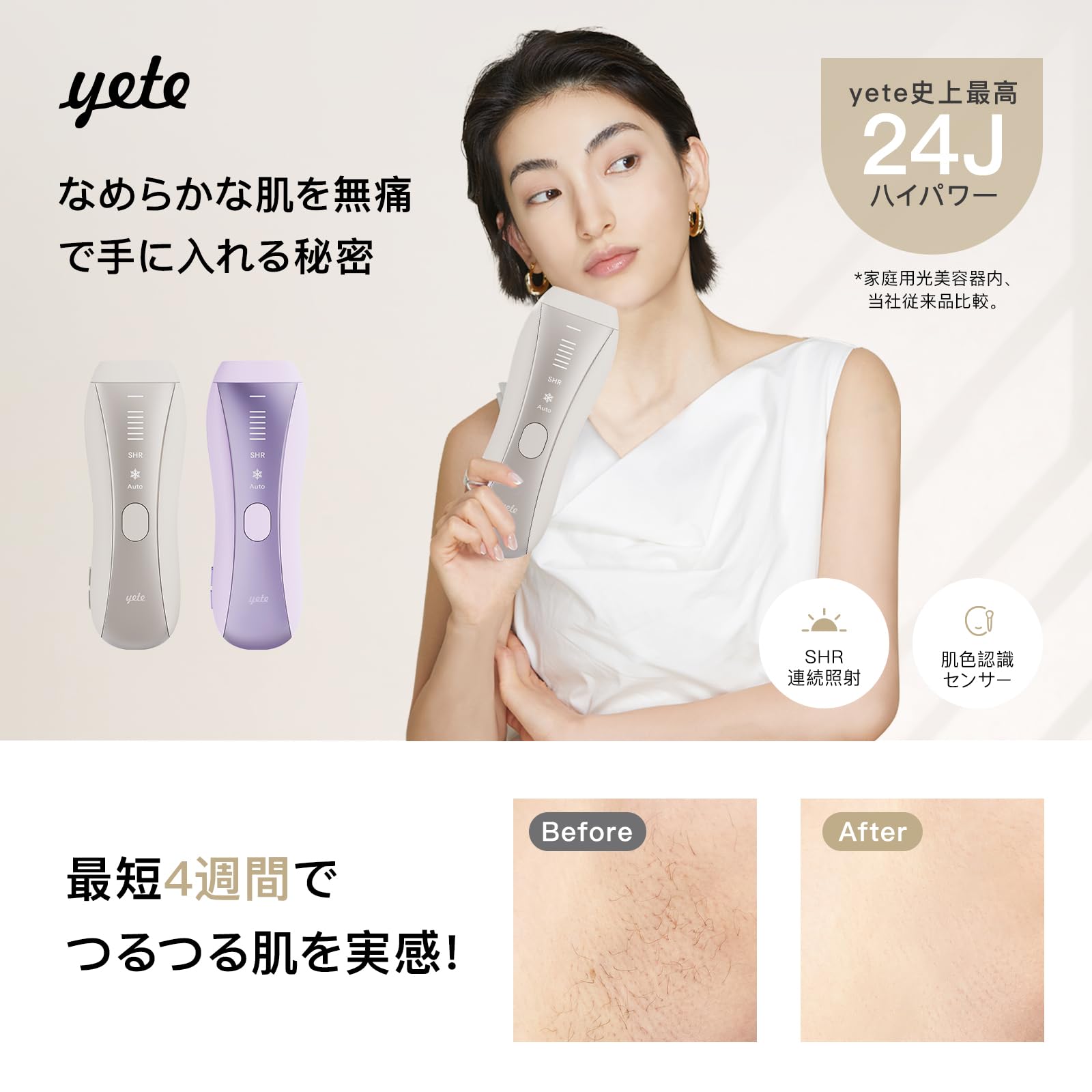 Yete（エイティー）脱毛器 【SHR6回連続照射】肌色識別機能 IPL光美容器 Amazon | Yete（エイティー）脱毛器 【SHR6回連続照射】肌色識別機能