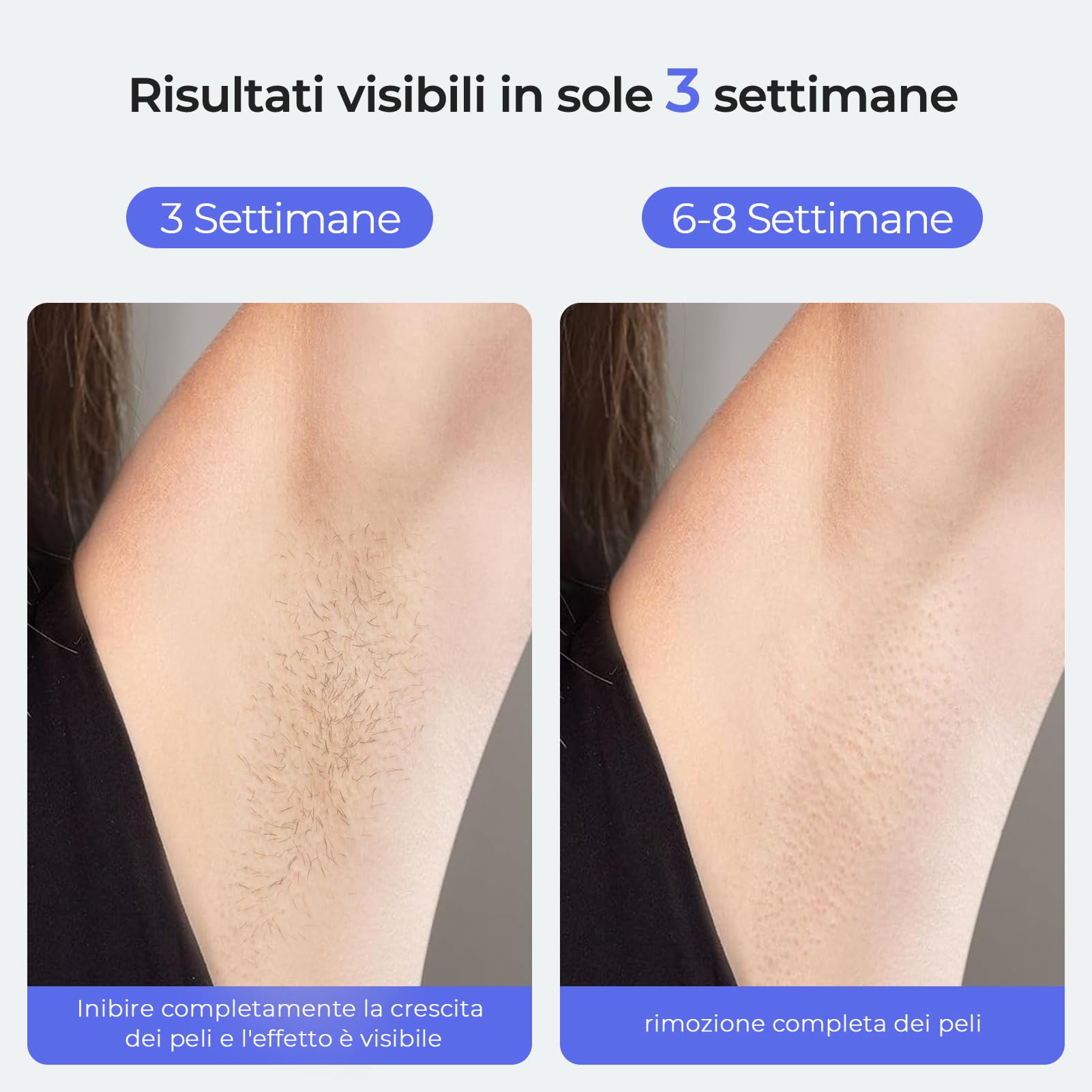 Dispositivo di Depilazione con Raffreddamento a Ghiaccio di Zaffiro, Epilatore Luce Pulsata Laser per Donne e Uomini, Alternativa al Salone Indolore Epilazione IPL per Viso, Bikini, Ascelle, Gambe