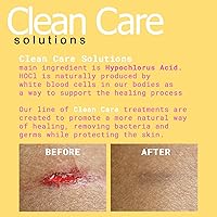 Vista 4 de Spray de ácido hipocloroso para el cuidado de heridas - Quemaduras, cortes e irritaciones de la piel - Natural, sin picaduras, seguro para áreas