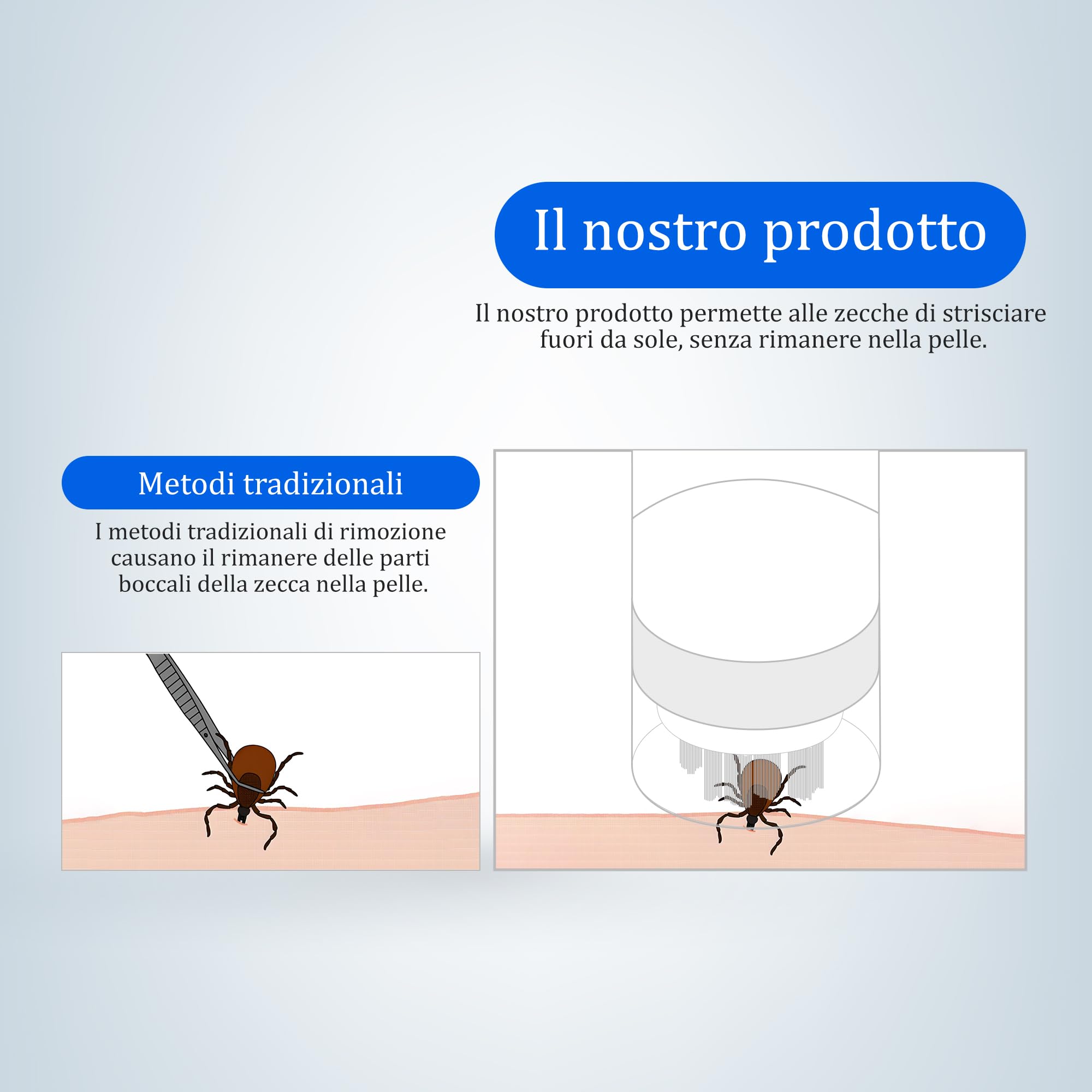 Kretrum Strumento per Rimozione delle Zecche Penna Premium Strumento Automatico per Rimozione delle Zecche per Cani Vero Strumento per Rimozione delle Zecche Indolore per Umani Un Clic per Rimuovere
