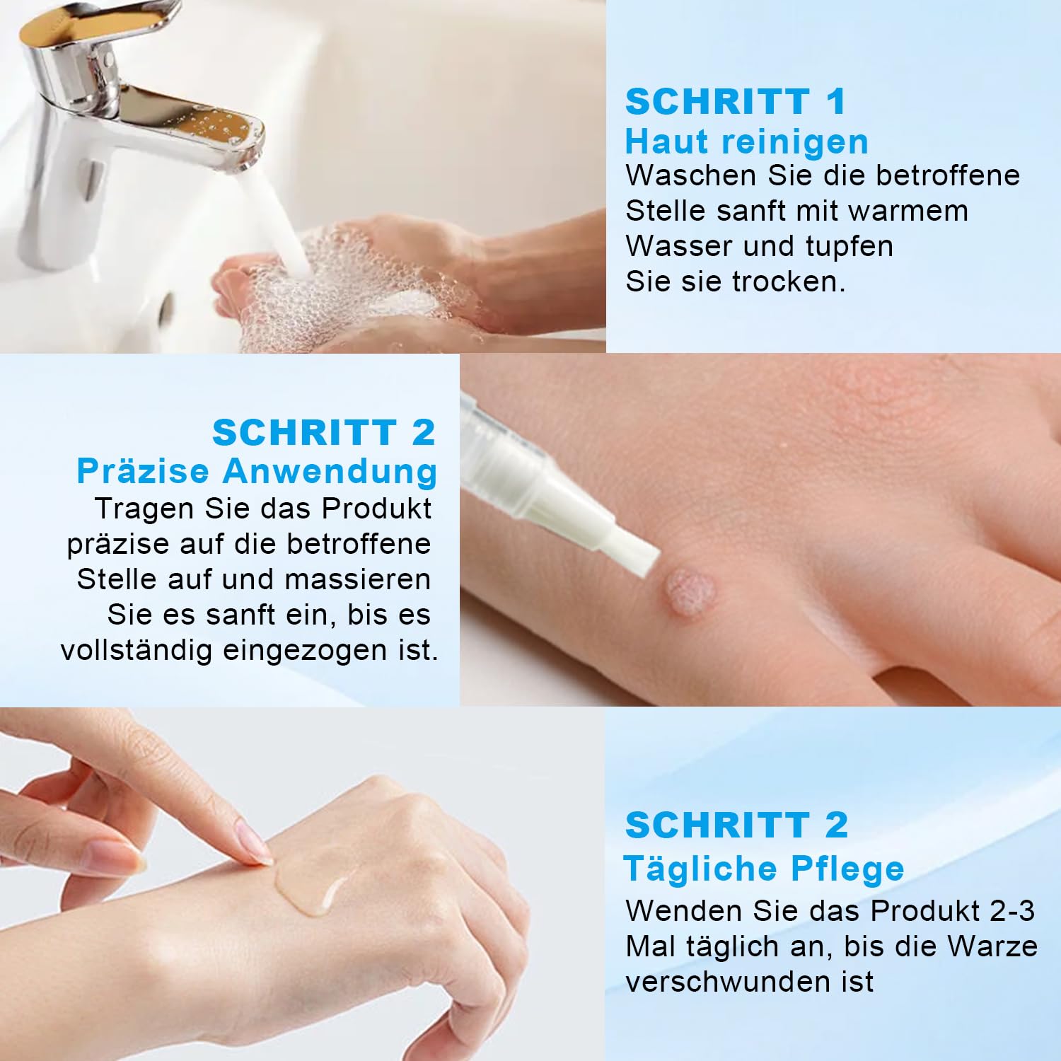 Sanfte Warzenentfernung für Gesicht & Körper - Schnell wirkendes Serum mit Präzisionsbürstenkopf gegen Hautirritationen, Dornwarzen & Flachwarzen, Sanfte Formel für sensible Haut, Reisegröße (2.5ml)