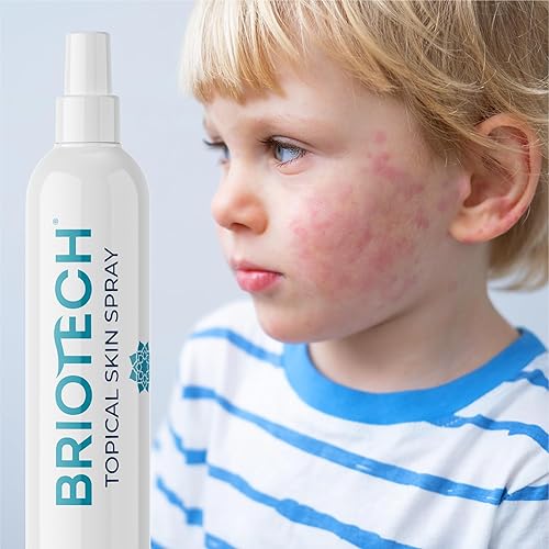 Miniatura 8 de BRIOTECH Aerosol tópico calmante para la piel, HOCl puro, rostro y cuerpo, alivia irritación, enrojecimiento, protuberancias en párpados, piel seca,