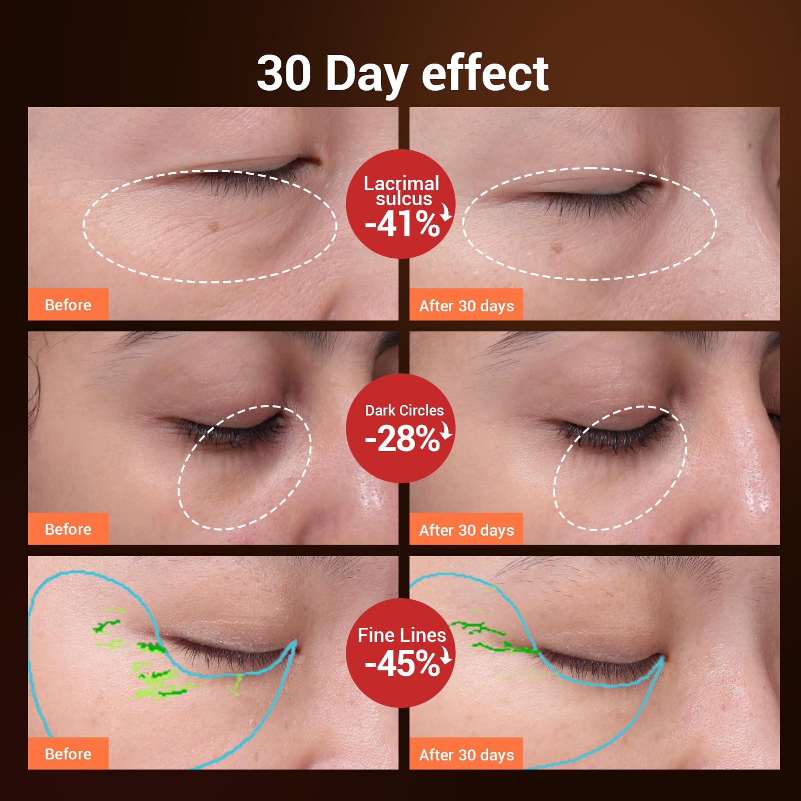 TOUCHBeauty Ultraschall Augenmassagegerät mit Wärmefunktion, Rot LED Lichttherapiegerät Augencreme Booster Augenring Tränensäcke Entferner USB-Wiederaufladbare Anti Aging Massagegerät Faltenentferner