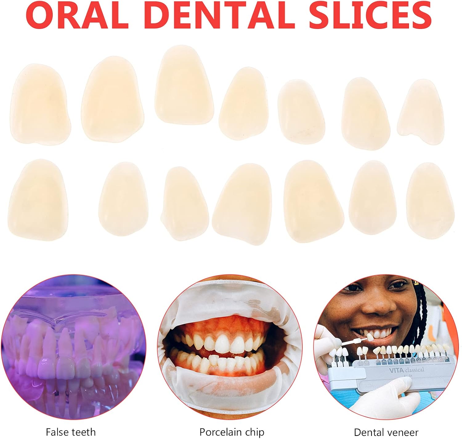 EXCEART 100 Pieces Artificial Resin Teeth Veneer Fillings - Temporary Replacements for Tooth Repair Supply