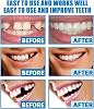 Temporary Tooth Filling Kit for Repair,Dental Repair Kit for Broken Teeth&Fake Teeth,Moldable Fake Teeth for at-Home Use,Dental Tools for Emergency Tooth Repair,Quick Solution,Versatile Applications